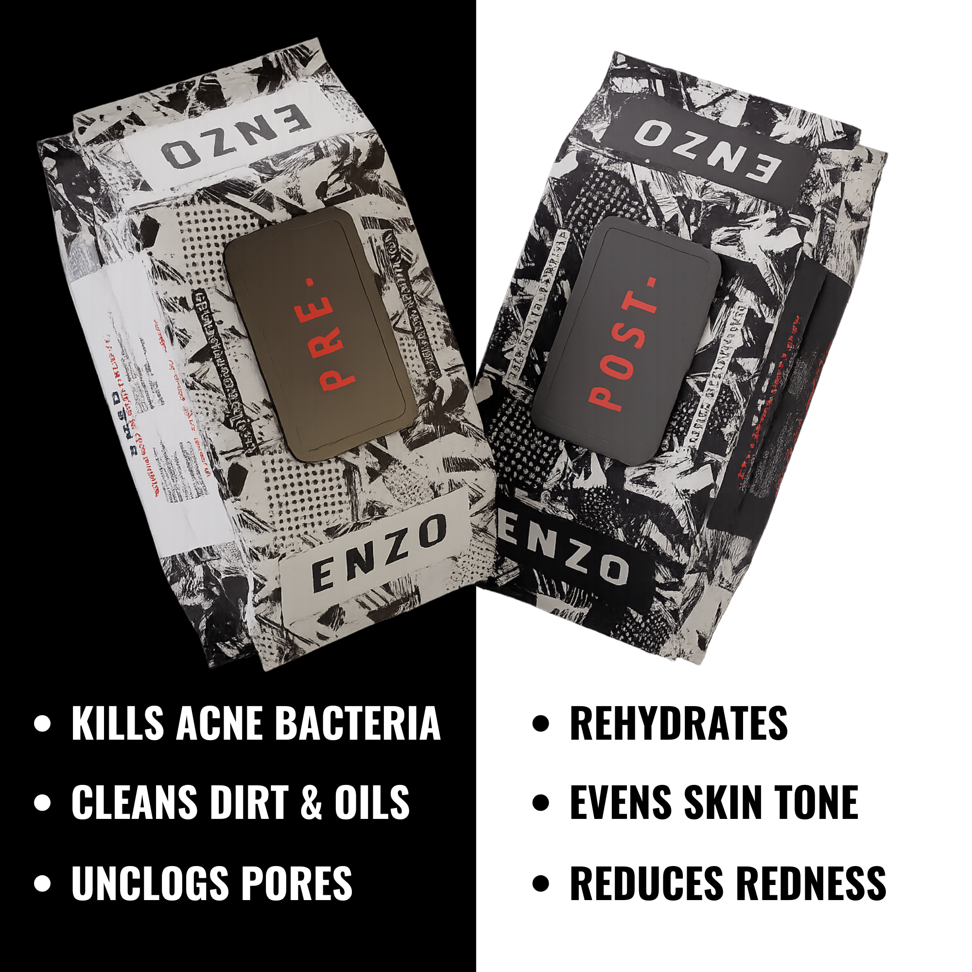 Enzo Face & Body Acne Wipes + Amazing Skincare