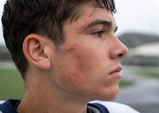 BREAKOUTS FROM HELMETS, PADS &amp; SWEAT