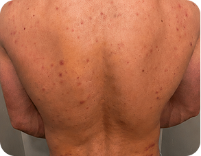 Before treatment comparison